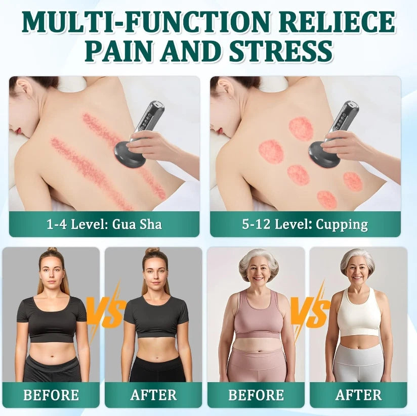 Electric Cupping Therapy Set Suction Cup Body Anti-Cellulite Scraping Massage